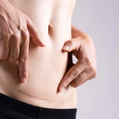 Estetyka ginekologiczna Łódź